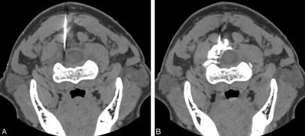 Fig 4.