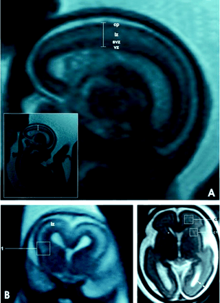 Fig 3.