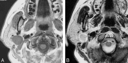 Fig 1.