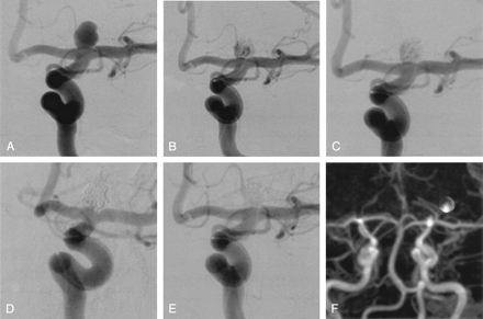 Fig 3.