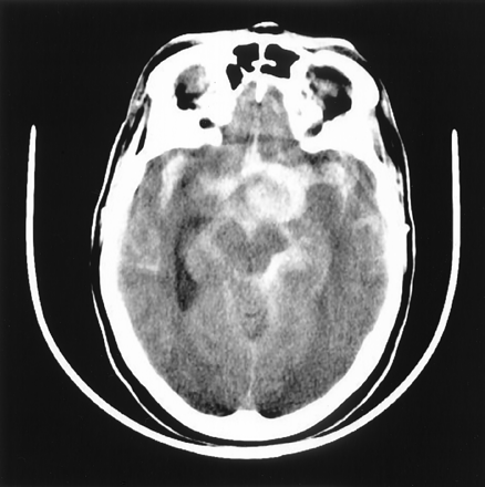 Fig 6.
