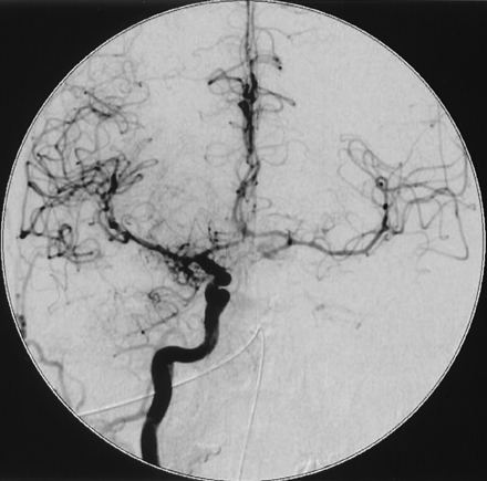 Fig 7.