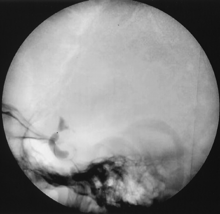 Fig 8.