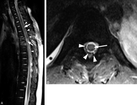 Fig 2.