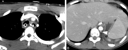Fig 3.