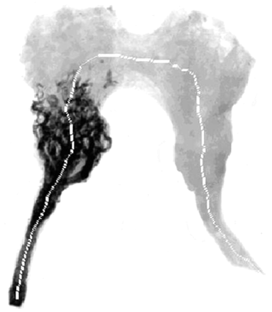 Fig 2.