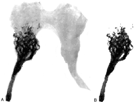 Fig 4.