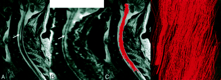 Fig 3.