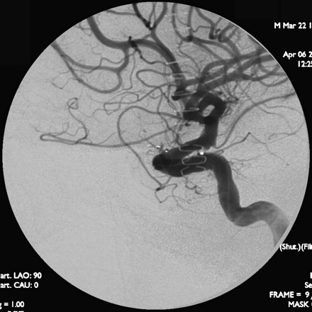 Fig 5.