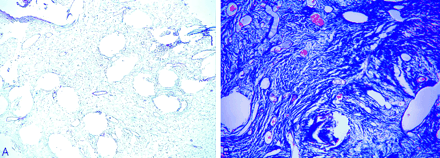 Fig 4.