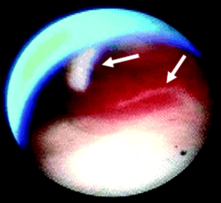 Fig 4.