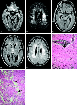 Fig 3.