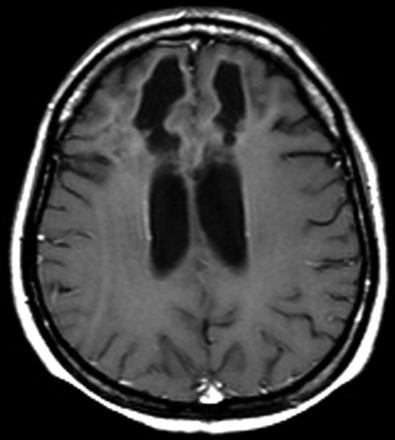 Fig 3.