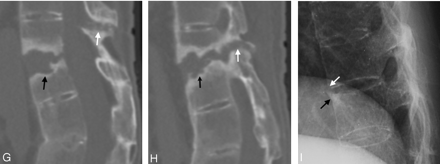 Fig 4.