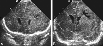 Fig 1.