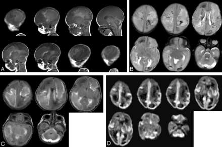 Fig 2.