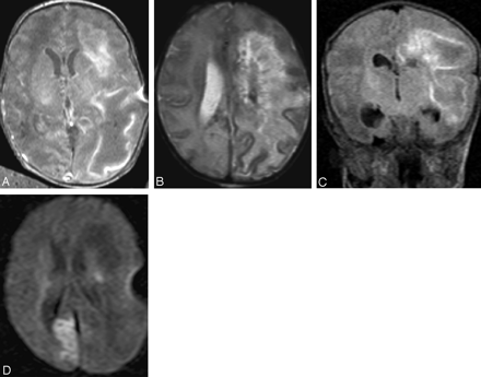 Fig 4.