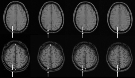 Fig 3.