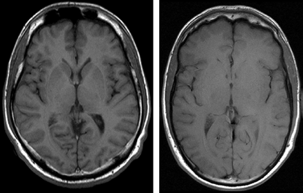 Fig 6.
