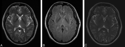 Fig 1.