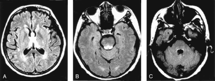 Fig 2.