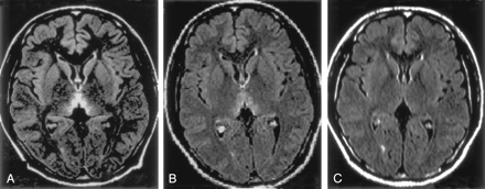 Fig 4.