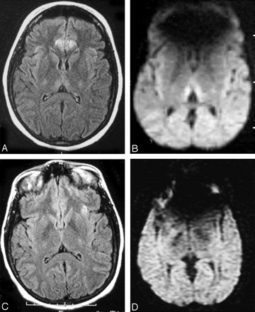 Fig 3.