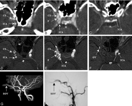 Fig 5.