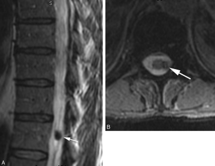 Fig 4.