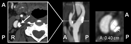 Fig 3.