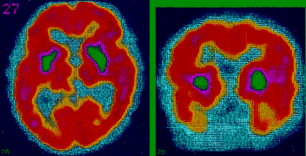 Fig 2.