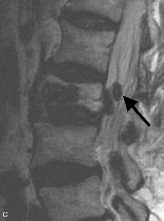 Fig 2.