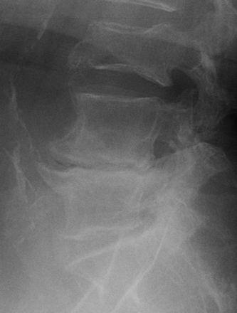 Fig 1.
