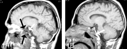 Fig 1.