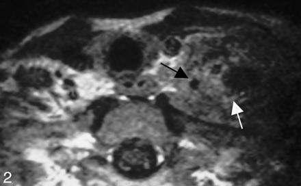 Fig 2.