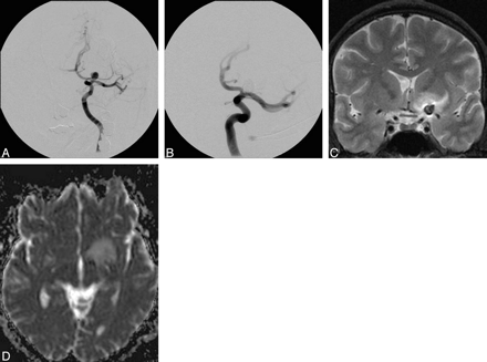 Fig 4.