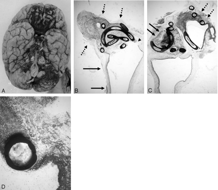 Fig 4.