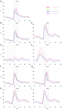Fig 6.
