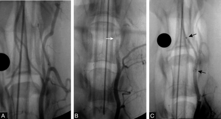Fig 1.