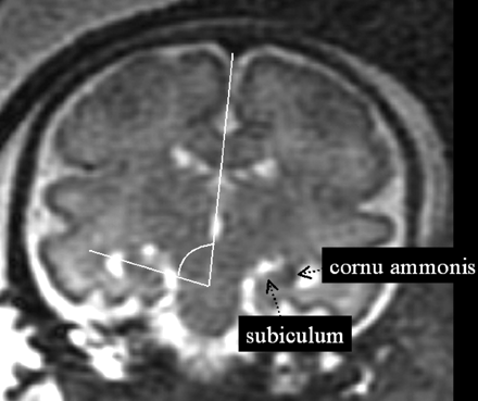 Fig 1.