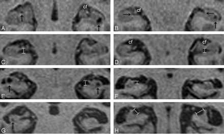 Fig 1.