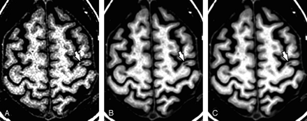 Fig 3.