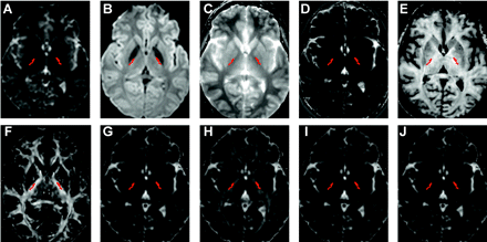 Fig 1.