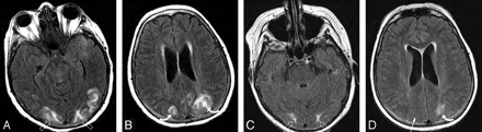 Fig 2.