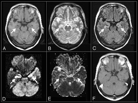 Fig 1.