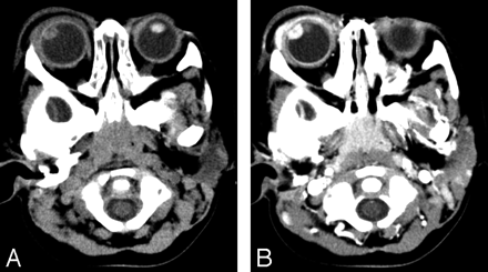 Fig 1.