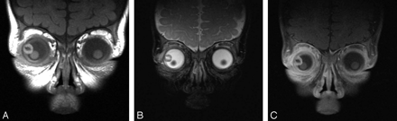 Fig 2.