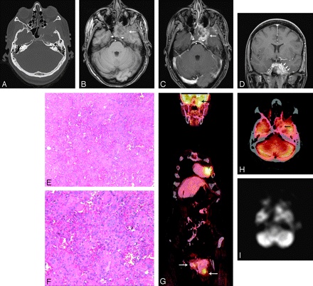  Fig 1. 