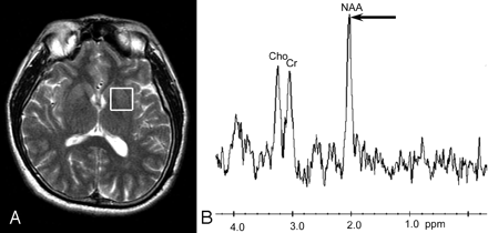 Fig 1.