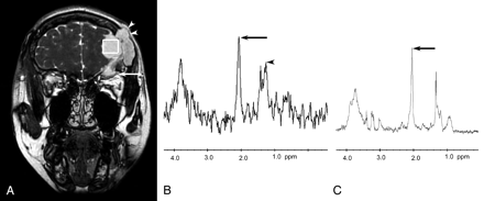 Fig 2.